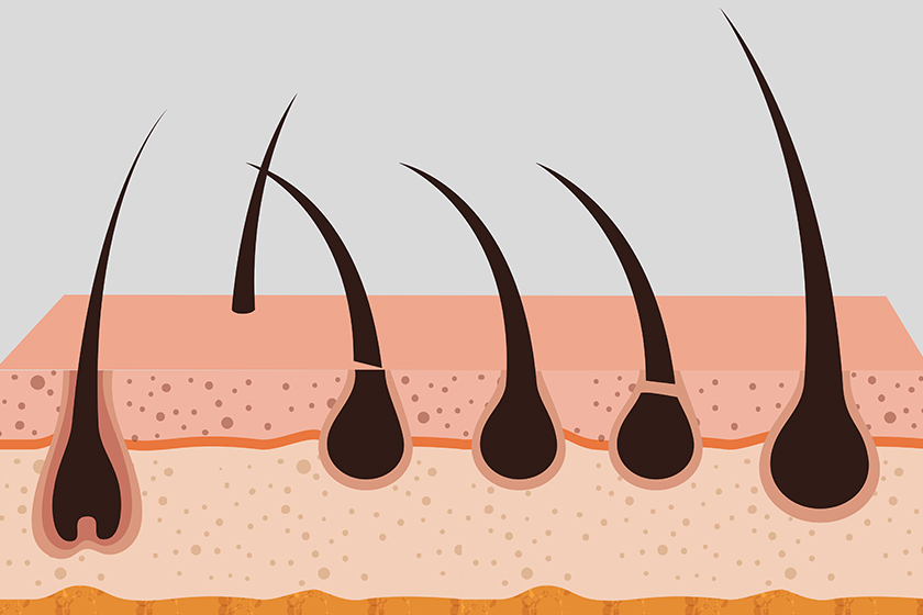 Hair Loss - Causes, Treatment and Preventions | Forest Essentials Hair Loss - Causes, Treatment and Preventions | Forest Essentials